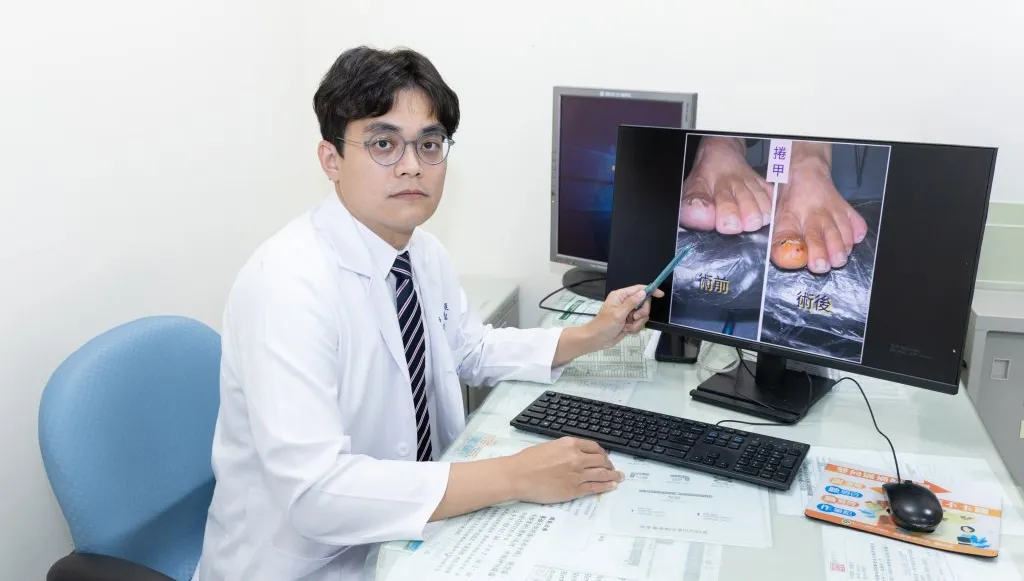 捲甲、嵌甲超擾人 甲床重建揮別腳趾疼痛