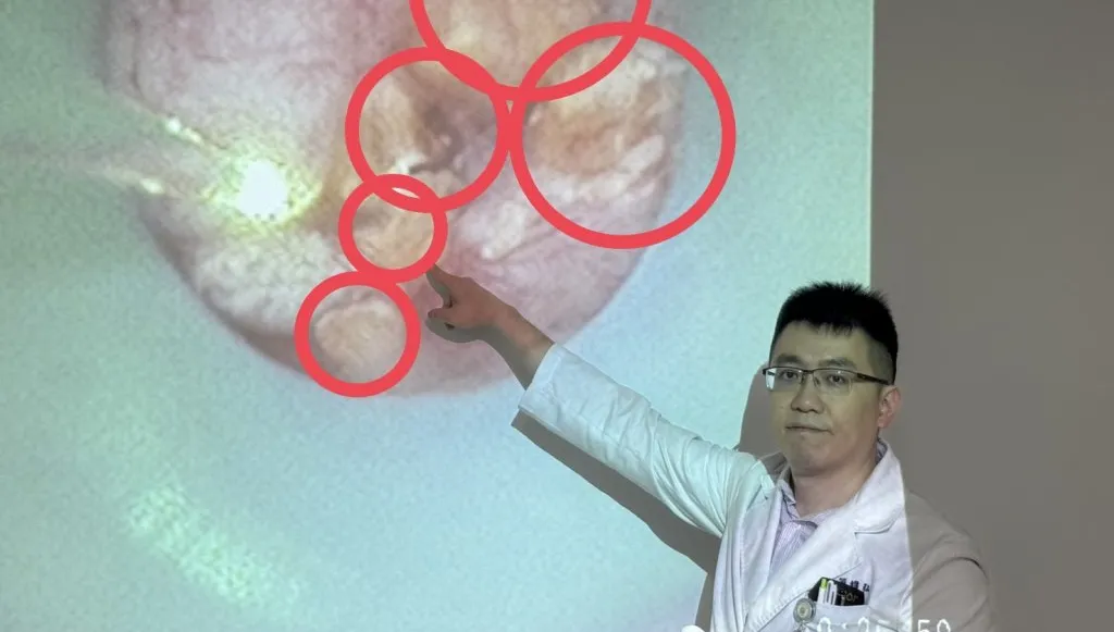 她的腎臟像長滿葡萄乾的雜糧麵包！  原來是「雷氏斑」作祟