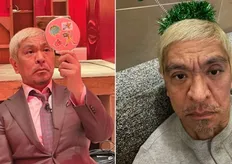 松本人志才爆性侵醜聞 震撼罹大腸癌「已裝人工肛門」