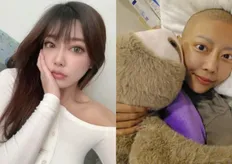 抗癌網紅黃橞病逝!曾被宣告剩3個月壽命 妹妹悲痛證實