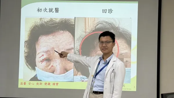 婦眼角冒水皰竟是「皮蛇」入侵！ 醫療團隊即時診治化解危機