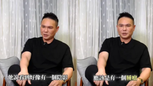 超哥驚爆罹大腸癌！「前後切30cm」最大遺憾錢沒花完