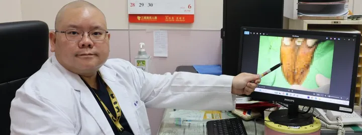 「中標」快去看醫生！30歲男下體長菜花拖2年 竟冒出103顆
